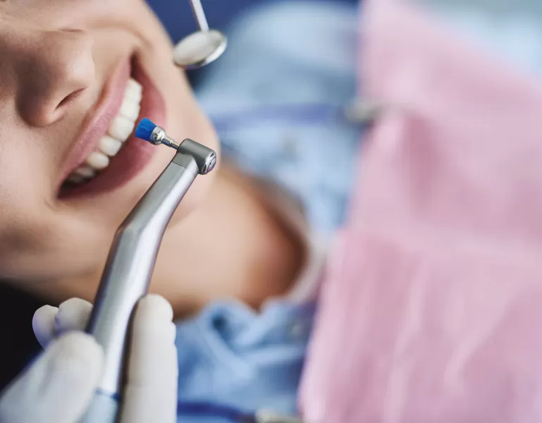Cos'è l'igiene orale professionale?